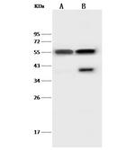 Desmin Antibody in Western Blot (WB)