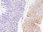 Desmin Antibody in Immunohistochemistry (Paraffin) (IHC (P))
