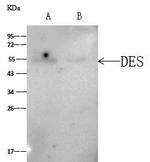 Desmin Antibody in Immunoprecipitation (IP)