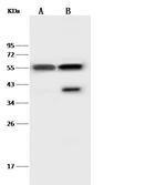 Desmin Antibody in Western Blot (WB)