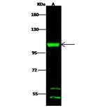 DHTKD1 Polyclonal Antibody