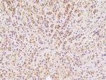 DIMT1 Polyclonal Antibody