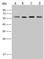 DLD Antibody in Western Blot (WB)