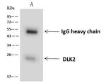 DLK2 Antibody in Immunoprecipitation (IP)