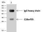 DNAJB11 Antibody in Immunoprecipitation (IP)
