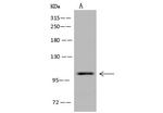 Dynamin 1 Polyclonal Antibody