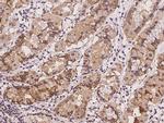 DTYMK Polyclonal Antibody