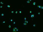 ECHDC1 Polyclonal Antibody