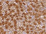 ECHDC1 Antibody in Immunohistochemistry (Paraffin) (IHC (P))