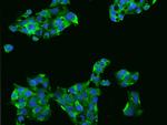 PERK Antibody in Immunocytochemistry (ICC/IF)
