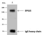 EPS15 Antibody in Immunoprecipitation (IP)