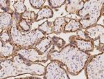 EPS8L2 Polyclonal Antibody