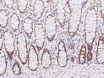 EXOSC7 Antibody in Immunohistochemistry (Paraffin) (IHC (P))