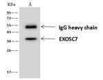 EXOSC7 Antibody in Immunoprecipitation (IP)