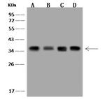 EXOSC7 Antibody in Western Blot (WB)