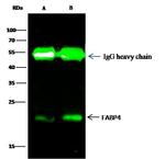 FABP4 Antibody in Immunoprecipitation (IP)
