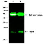 FABP4 Antibody in Immunoprecipitation (IP)