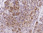 FABP7 Polyclonal Antibody