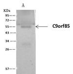 FADS3 Antibody in Immunoprecipitation (IP)