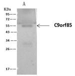 FADS3 Antibody in Immunoprecipitation (IP)