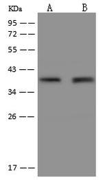 FAM76B Polyclonal Antibody