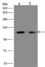 FBF1 Polyclonal Antibody