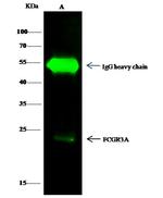 FCGR3A Antibody in Immunoprecipitation (IP)
