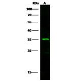 FCGR3A Polyclonal Antibody