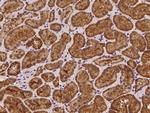 FHIT Antibody in Immunohistochemistry (Paraffin) (IHC (P))