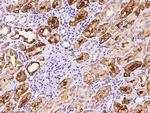 FIGNL1 Antibody in Immunohistochemistry (Paraffin) (IHC (P))
