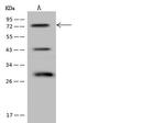 FIGNL1 Antibody in Western Blot (WB)