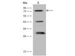 FIGNL1 Antibody in Western Blot (WB)