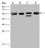FKBP5 Antibody in Western Blot (WB)