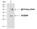 FN3KRP Antibody in Immunoprecipitation (IP)