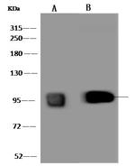 FOXK1 Antibody in Western Blot (WB)