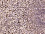 G6PD Polyclonal Antibody
