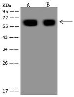 GAD65 Polyclonal Antibody