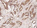 GAP43 Polyclonal Antibody
