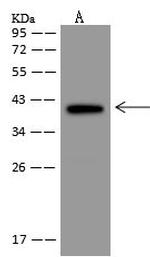 GDPGP1 Polyclonal Antibody