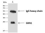 GKN1 Antibody in Immunoprecipitation (IP)