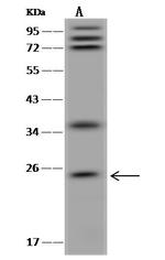 GKN1 Polyclonal Antibody