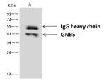 GNB5 Antibody in Immunoprecipitation (IP)