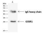 GOSR1 Antibody in Immunoprecipitation (IP)