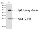 GSTT2B Antibody in Immunoprecipitation (IP)