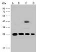 GSTT2B Polyclonal Antibody