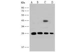 GSTT2B Antibody in Western Blot (WB)