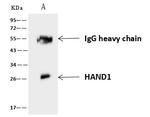 HAND1 Antibody in Immunoprecipitation (IP)