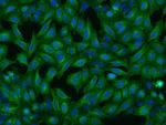 HAUS1 Antibody in Immunocytochemistry (ICC/IF)