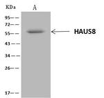 HICE1 Antibody in Immunoprecipitation (IP)