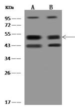 HICE1 Polyclonal Antibody